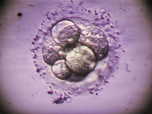 Научници ће уређивати гене људских ембриона?