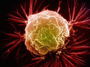 За развој имунотерапије 125 милиона долара 