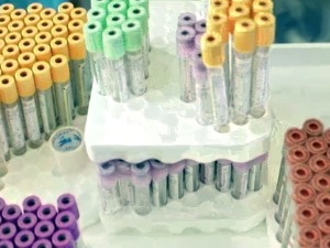 Рихтман: Није битно чија је застава на кутији, вакцина коју можете да примите је најбоља