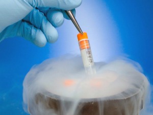 За парове важан јединствен став лекара који се баве вантелесном оплодњом