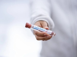 САД и 13 земаља сумњају у извештај СЗО о пореклу коронавируса