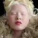 Од сиротишта до „Вога“: Девојка са албинизмом постала модел