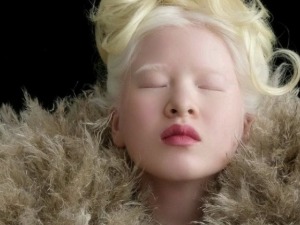 Од сиротишта до „Вога“: Девојка са албинизмом постала модел