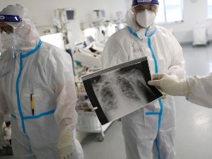 Утичу ли генетске предиспозиције на тежину слике ковид оболелих – истраживање у Србији даће одговор