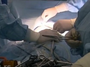 Више од 50.000 нековид пацијената чека на операције