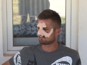 Претучени младић из Новог Брда после операције пуштен из болнице