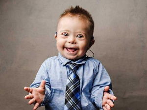 Ту сам - Даунов синдром, суочавање