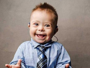 Ту сам - Даунов синдром, суочење