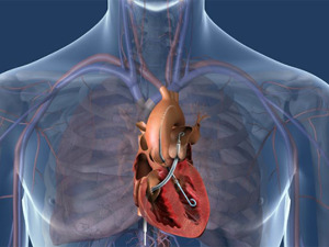 Српски кардиолози у корак са светским трендовима у лечењу кардиоваскуларних болести