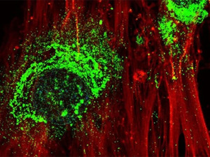 Научници успели да претворе матичне ћелије у кост само помоћу звучних таласа