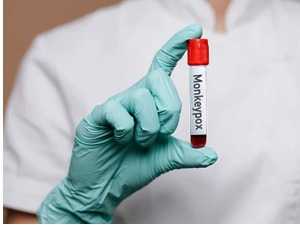 "Батут" објавио шта све треба да знамо о мајмунским богињама