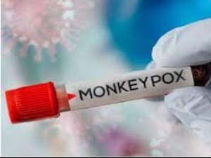 Очекују ли се мајмунске богиње у Србији – каква су "Батутова" упутства лекарима