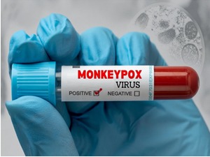 Регистрован први случај мајмунских богиња у Србији