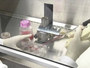 Трансфузија матичним ћелијама за многе је једина шанса, како да постанете давалац