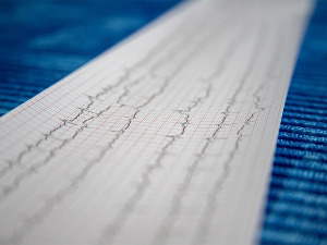 Срчано навијамо за наше спортисте, али срце некад то не може да издржи