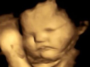 О, не, само не кељ! И нерођене бебе у мајчиним стомацима „слажу фаце“ када пробају кељ