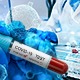 Preminulo 7 pacijenata, koronavirusom zaražene još  1.872 osobe