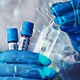 Preminulo pet pacijenata, koronavirusom zaraženo još 368 osoba