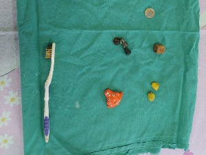 Батерија, новчић, четкица за зубе, игла – шта све деца гутају и шта је најопасније