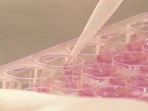 "Ослони се на мене" за већи број давалаца матичних ћелија