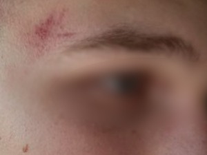 Нападнут дечак у Сувом Долу