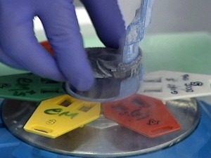 Из Шпаније стигле прве дониране јајне ћелије, пријављено 500 парова - који су критеријуми 