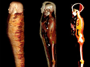 ЦТ снимци мумије „Златног дечака“ расветлили 2.300 година старе тајне